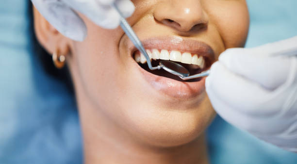 Best Same-Day Emergency Dental Services in Clemson University, SC